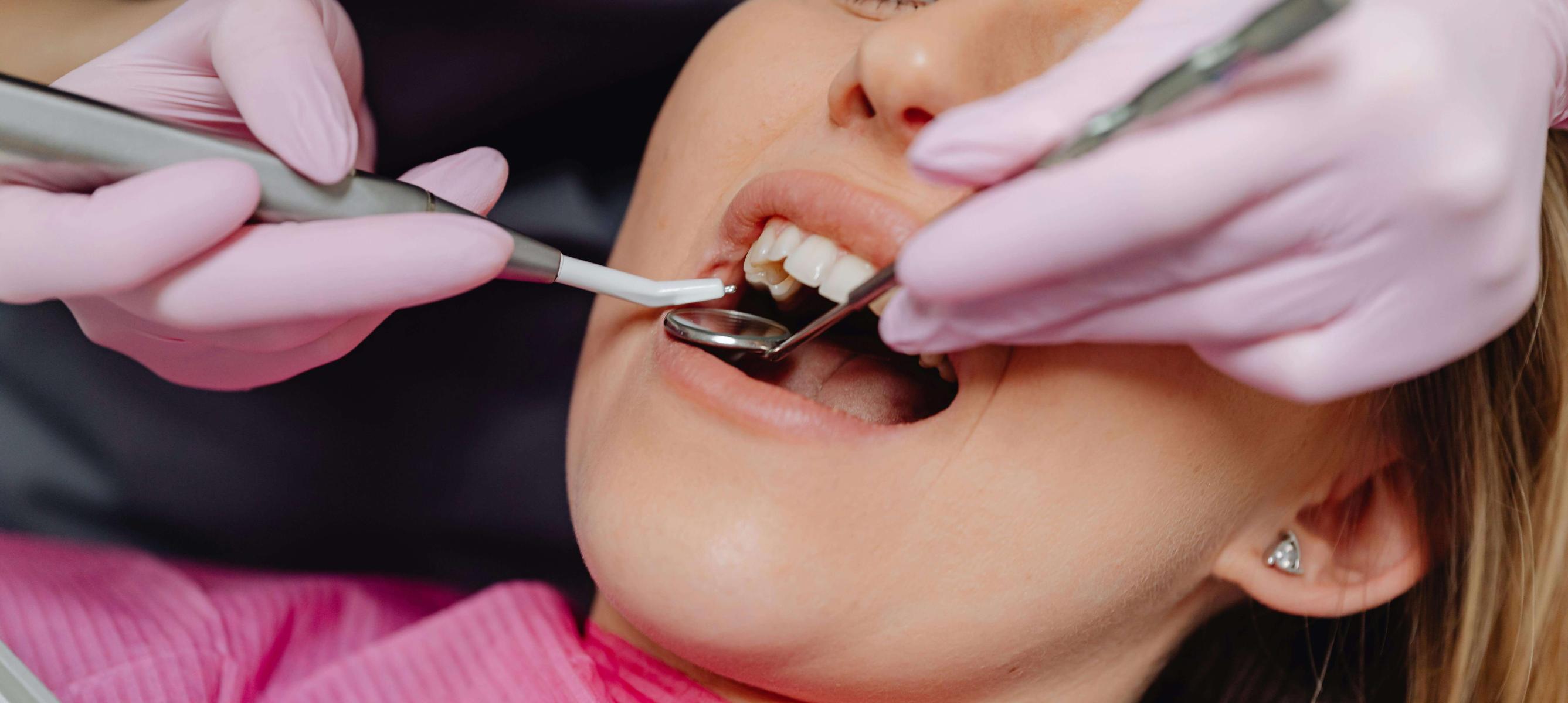 Dental Care: Kunci Senyum Sehat dan Percaya Diri