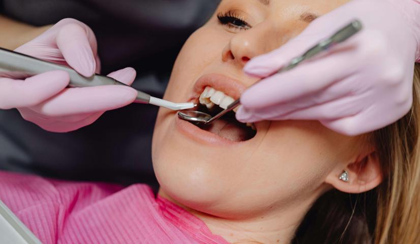 Dental Care: Kunci Senyum Sehat dan Percaya Diri